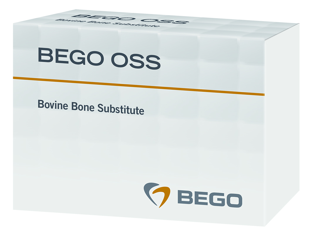 Foto von BEGO OSS