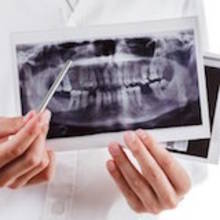 Beihilfe Erstattung Implantat