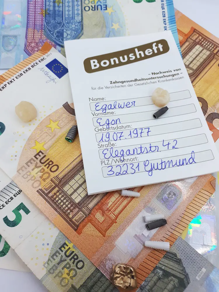 Zahlt die Krankenkasse für Implantate?