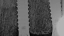 Ein Röntgenbild zeigt zwei Zahnimplantate, die in den Kieferknochen eingebettet sind. Diese Implantate erscheinen als helle, schraubenartige Strukturen vor einem dunkleren Hintergrund, der den umgebenden Knochen und das Gewebe darstellt. Dieser Zahnersatz zeigt die Präzision moderner Zahntechniken.
