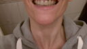 Eine Person in einem grauen Kapuzenpullover lächelt breit und zeigt ihre Zähne, möglicherweise aufgrund kürzlicher Implantate. Sie steht in einem Innenbereich mit einer gefliesten Wand im Hintergrund.