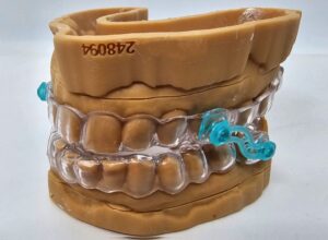 Unterkiefer Protrusionsschiene-Schnarchschiene