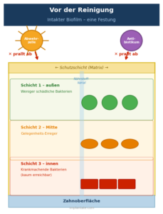 Antibiotika: kaum Wirkung bei intaktem Biofilm