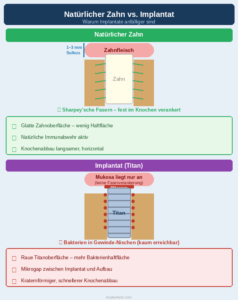 Biofilm: Implantat und Zahn unterscheiden sich