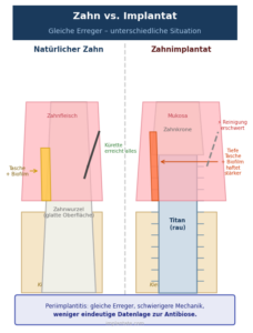 Periimplantitis PArodontitis Implantat vs. Zahn Antibiose