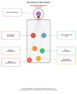 Parodontitis: Risiko für die Allgemeingesundheit