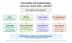 Zahnseide bei Implantaten; wann, wie