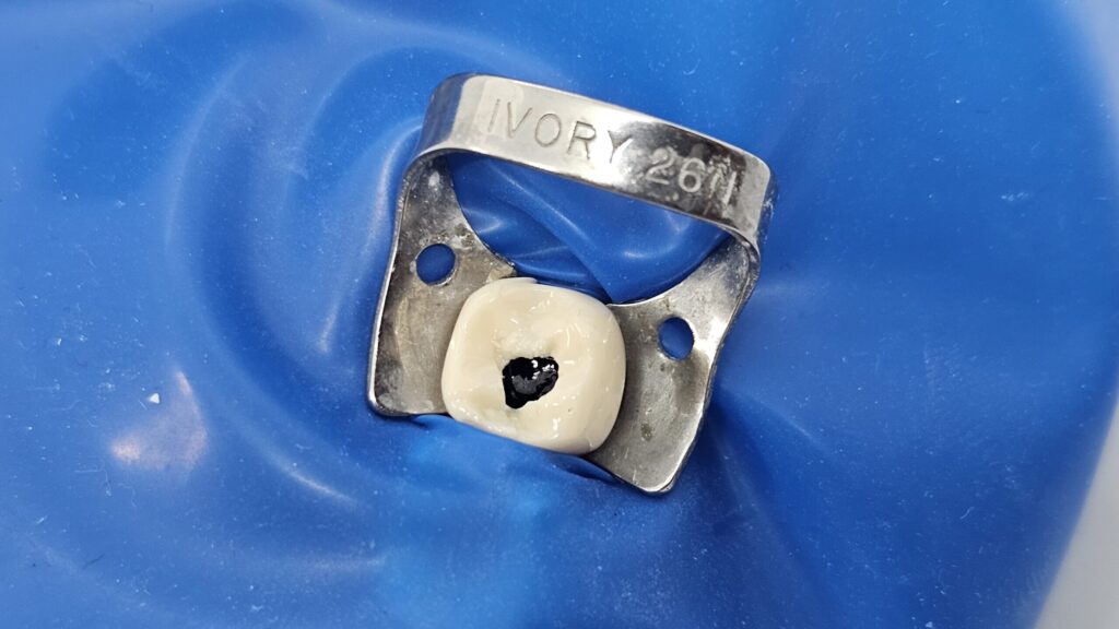 Metallene Kofferdamklammer zur Fixierung des Spanngummis am Zahn